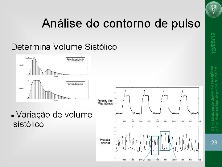 Variação de volume sistólico CT de Medicina de Urgência e Emergência CT de Medicina Variação de volume sistólico CT de Medicina de Urgência e Emergência CT de Medicina