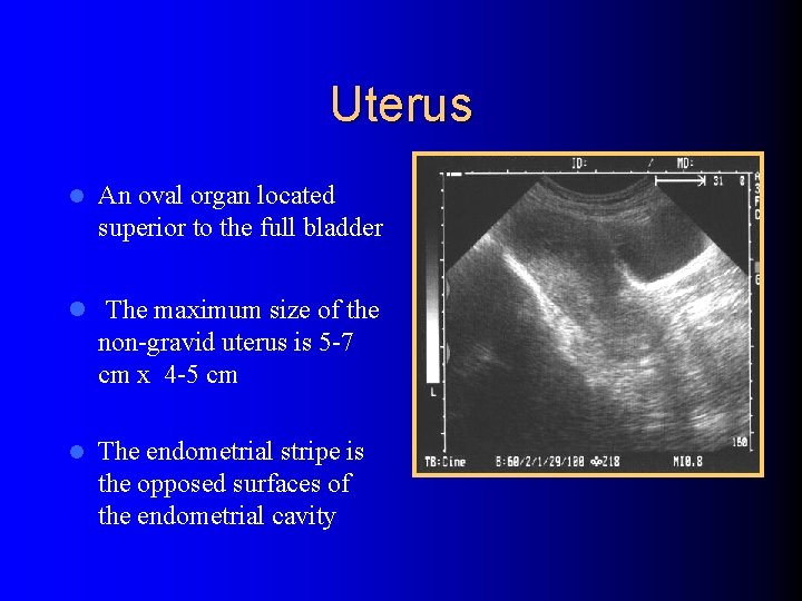 Uterus l An oval organ located superior to the full bladder l The maximum