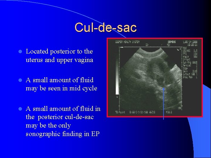 Cul-de-sac l Located posterior to the uterus and upper vagina l A small amount