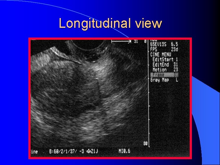 Longitudinal view 