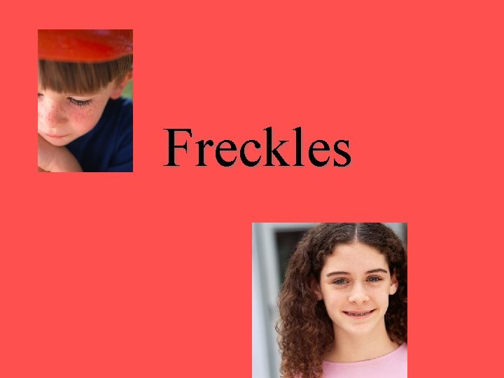 Freckles Freckles