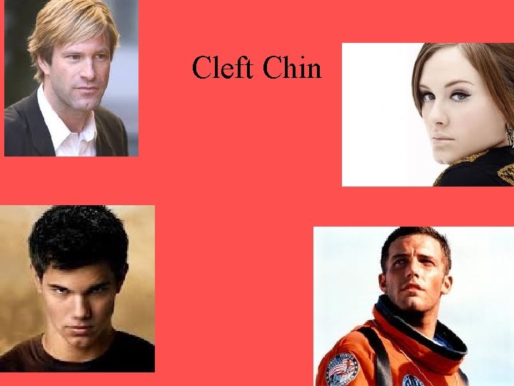 Cleft Chin Cleft Chin