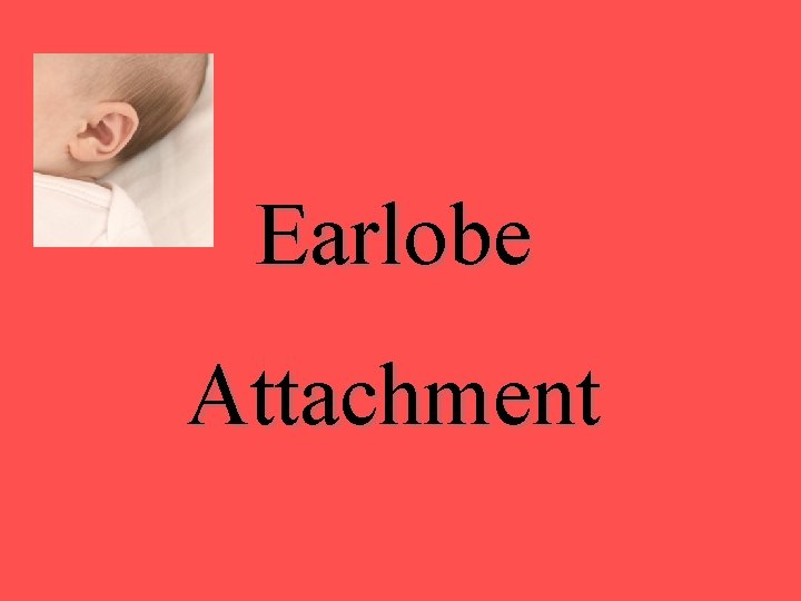 Earlobe Attachment Earlobe Attachment