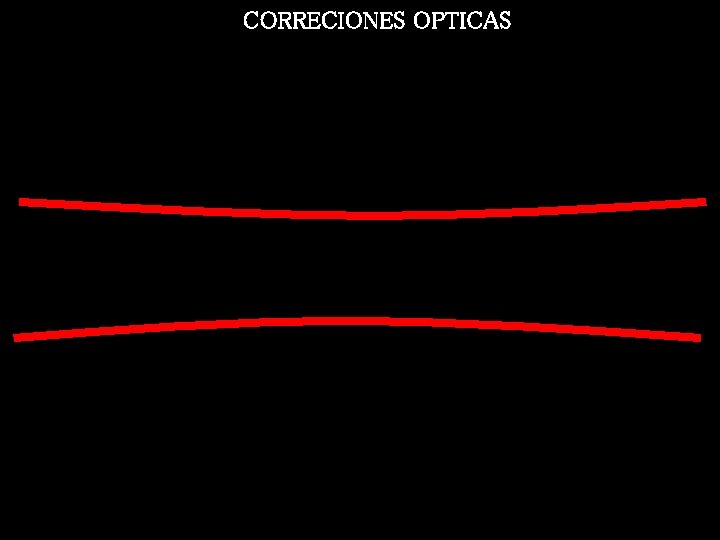 CORRECIONES OPTICAS 
