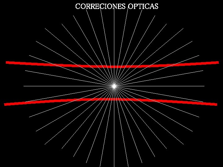 CORRECIONES OPTICAS 