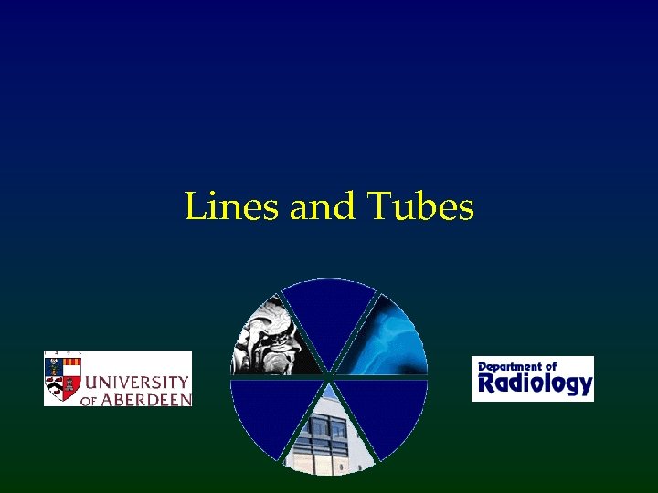 Lines and Tubes 