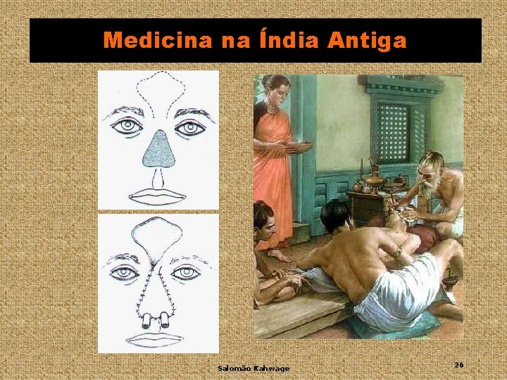 Medicina na Índia Antiga Salomão Kahwage 26 