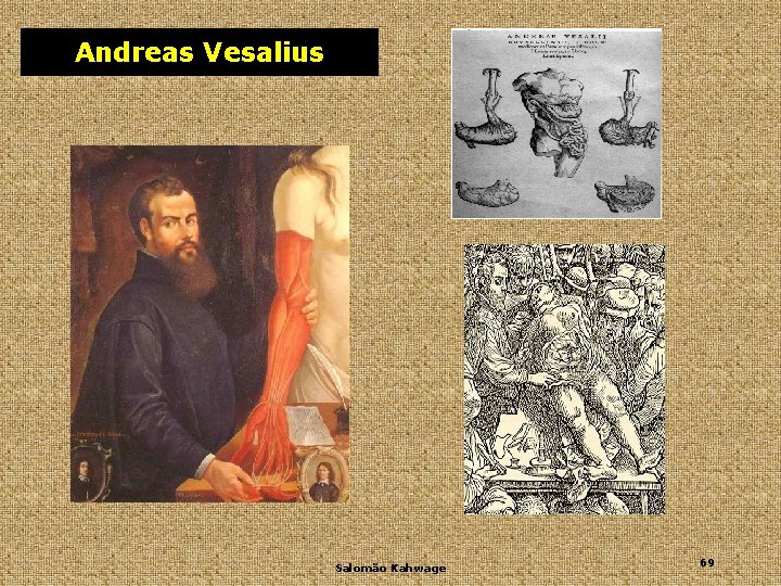 Andreas Vesalius Salomão Kahwage 69 