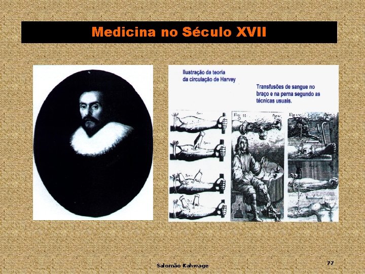 Medicina no Século XVII Salomão Kahwage 77 