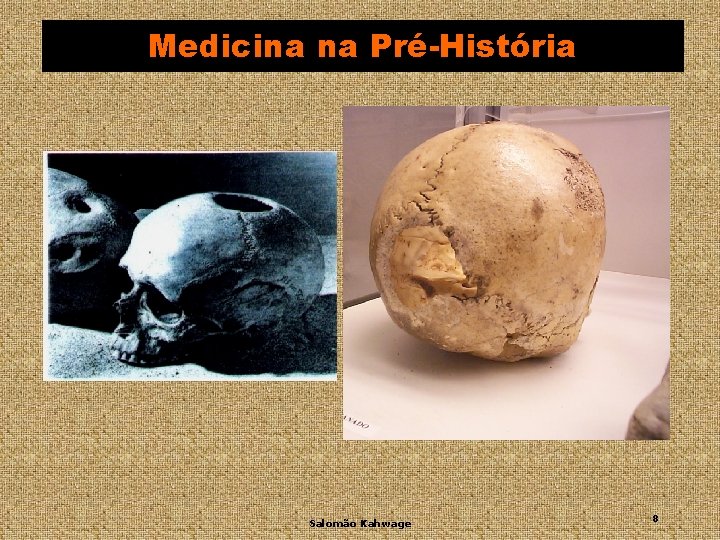 Medicina na Pré-História Salomão Kahwage 8 