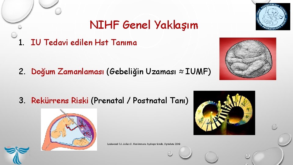 NIHF Genel Yaklaşım 1. IU Tedavi edilen Hst Tanıma 2. Doğum Zamanlaması (Gebeliğin Uzaması NIHF Genel Yaklaşım 1. IU Tedavi edilen Hst Tanıma 2. Doğum Zamanlaması (Gebeliğin Uzaması