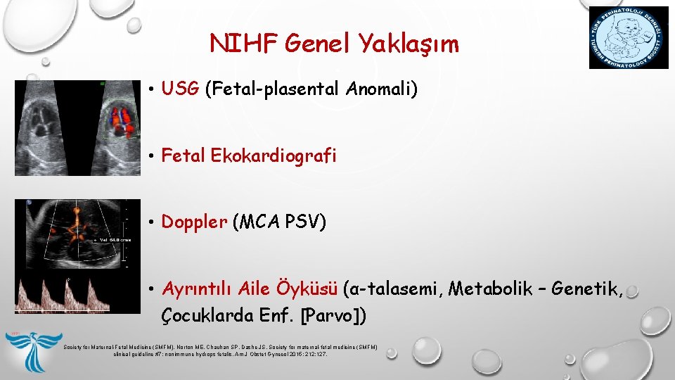 NIHF Genel Yaklaşım • USG (Fetal-plasental Anomali) • Fetal Ekokardiografi • Doppler (MCA PSV) NIHF Genel Yaklaşım • USG (Fetal-plasental Anomali) • Fetal Ekokardiografi • Doppler (MCA PSV)