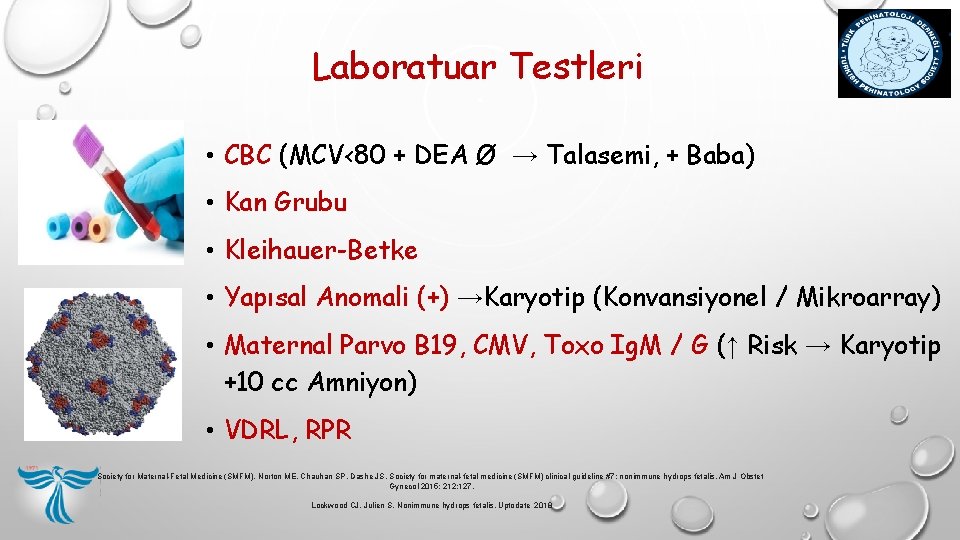 Laboratuar Testleri • CBC (MCV<80 + DEA Ø → Talasemi, + Baba) • Kan Laboratuar Testleri • CBC (MCV<80 + DEA Ø → Talasemi, + Baba) • Kan
