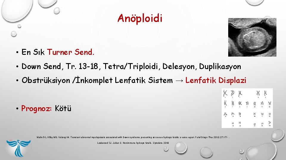 Anöploidi • En Sık Turner Send. • Down Send, Tr. 13 -18, Tetra/Triploidi, Delesyon, Anöploidi • En Sık Turner Send. • Down Send, Tr. 13 -18, Tetra/Triploidi, Delesyon,