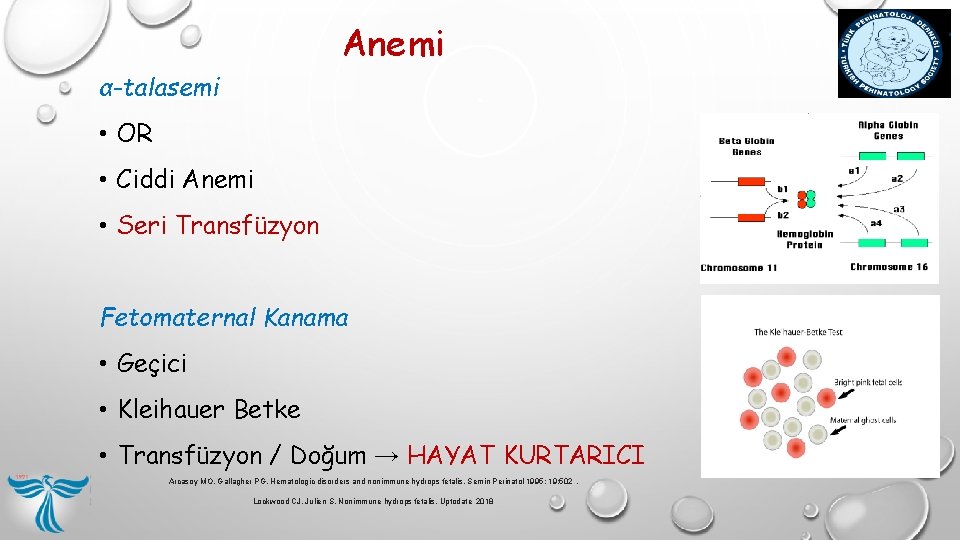 Anemi α-talasemi • OR • Ciddi Anemi • Seri Transfüzyon Fetomaternal Kanama • Geçici Anemi α-talasemi • OR • Ciddi Anemi • Seri Transfüzyon Fetomaternal Kanama • Geçici