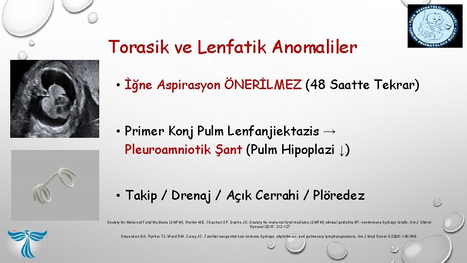 Torasik ve Lenfatik Anomaliler • İğne Aspirasyon ÖNERİLMEZ (48 Saatte Tekrar) • Primer Konj Torasik ve Lenfatik Anomaliler • İğne Aspirasyon ÖNERİLMEZ (48 Saatte Tekrar) • Primer Konj
