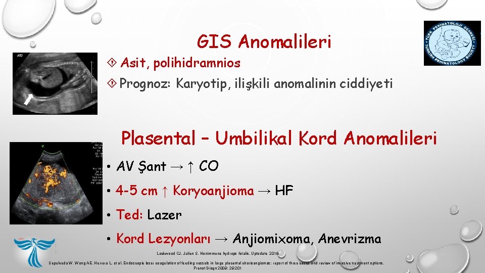 GIS Anomalileri Asit, polihidramnios Prognoz: Karyotip, ilişkili anomalinin ciddiyeti Plasental – Umbilikal Kord Anomalileri GIS Anomalileri Asit, polihidramnios Prognoz: Karyotip, ilişkili anomalinin ciddiyeti Plasental – Umbilikal Kord Anomalileri