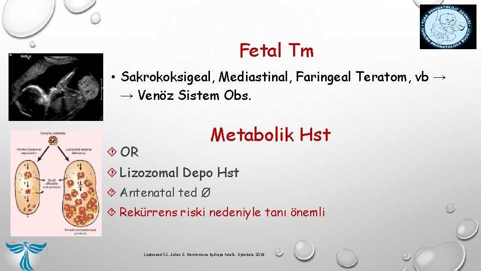 Fetal Tm • Sakrokoksigeal, Mediastinal, Faringeal Teratom, vb → → Venöz Sistem Obs. OR Fetal Tm • Sakrokoksigeal, Mediastinal, Faringeal Teratom, vb → → Venöz Sistem Obs. OR