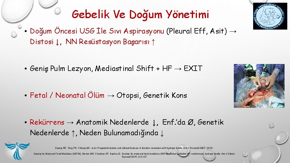 Gebelik Ve Doğum Yönetimi • Doğum Öncesi USG İle Sıvı Aspirasyonu (Pleural Eff, Asit) Gebelik Ve Doğum Yönetimi • Doğum Öncesi USG İle Sıvı Aspirasyonu (Pleural Eff, Asit)