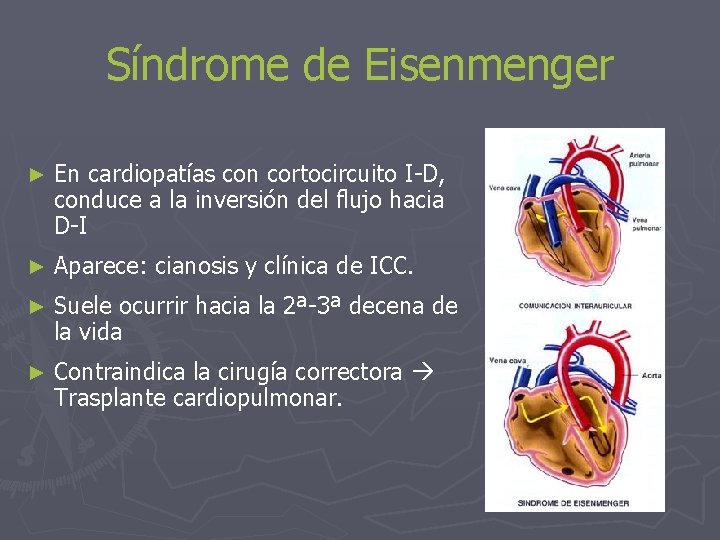 Síndrome de Eisenmenger ► En cardiopatías con cortocircuito I-D, conduce a la inversión del