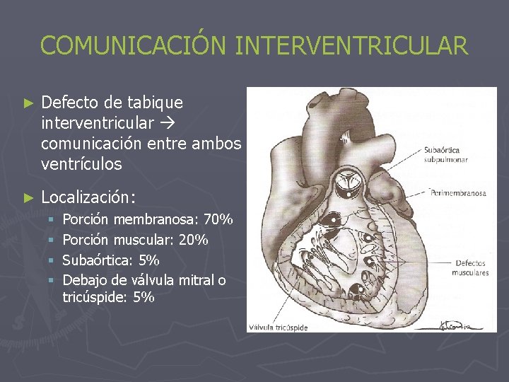 COMUNICACIÓN INTERVENTRICULAR ► Defecto de tabique interventricular comunicación entre ambos ventrículos ► Localización: §