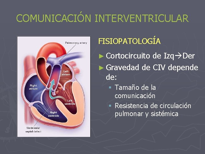 COMUNICACIÓN INTERVENTRICULAR FISIOPATOLOGÍA ► Cortocircuito de Izq Der ► Gravedad de CIV depende de: