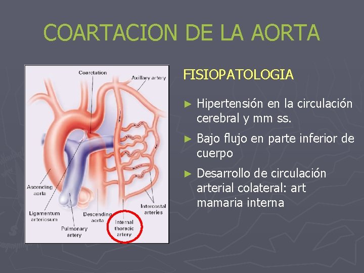 COARTACION DE LA AORTA FISIOPATOLOGIA ► Hipertensión en la circulación cerebral y mm ss.