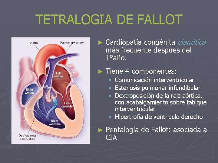 TETRALOGIA DE FALLOT ► Cardiopatía congénita cianótica más frecuente después del 1°año. ► Tiene