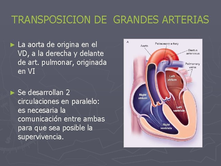 TRANSPOSICION DE GRANDES ARTERIAS ► La aorta de origina en el VD, a la