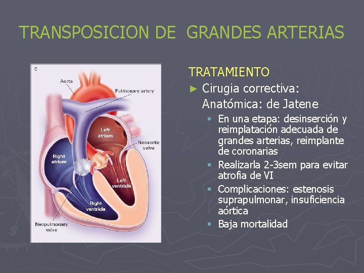 TRANSPOSICION DE GRANDES ARTERIAS TRATAMIENTO ► Cirugia correctiva: Anatómica: de Jatene § En una