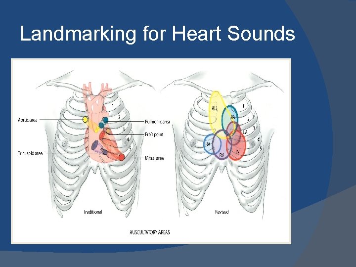 Landmarking for Heart Sounds 