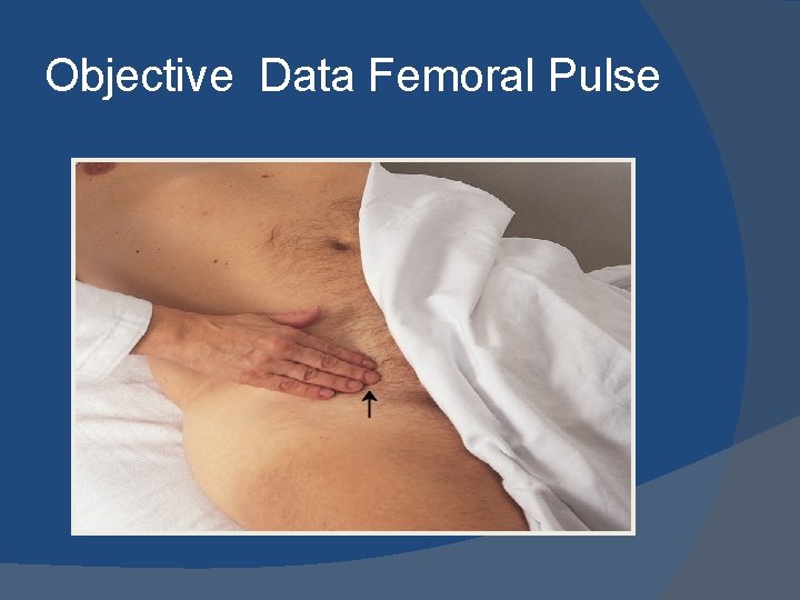 Objective Data Femoral Pulse 