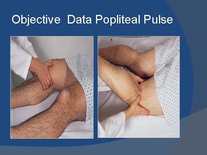 Objective Data Popliteal Pulse 