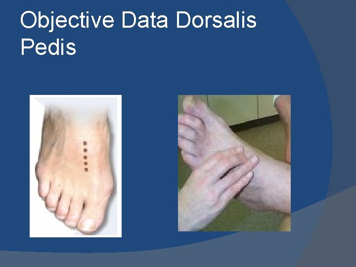 Objective Data Dorsalis Pedis 