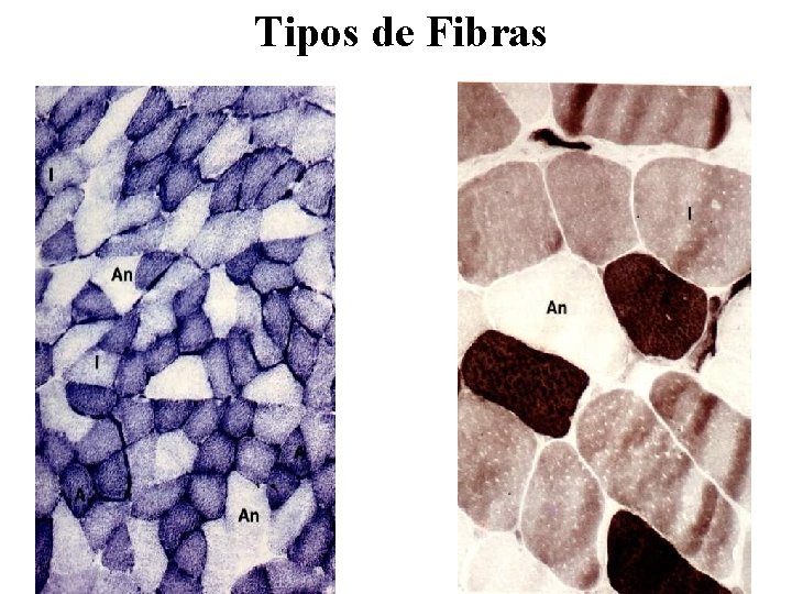 Tipos de Fibras 