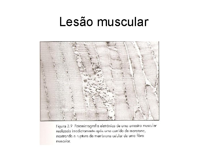 Lesão muscular 