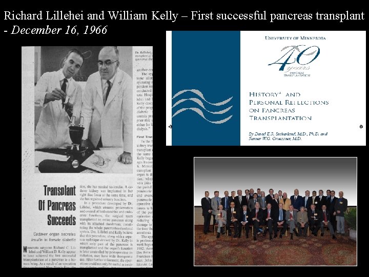 Richard Lillehei and William Kelly – First successful pancreas transplant - December 16, 1966