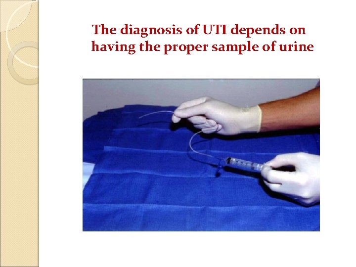 The diagnosis of UTI depends on having the proper sample of urine 