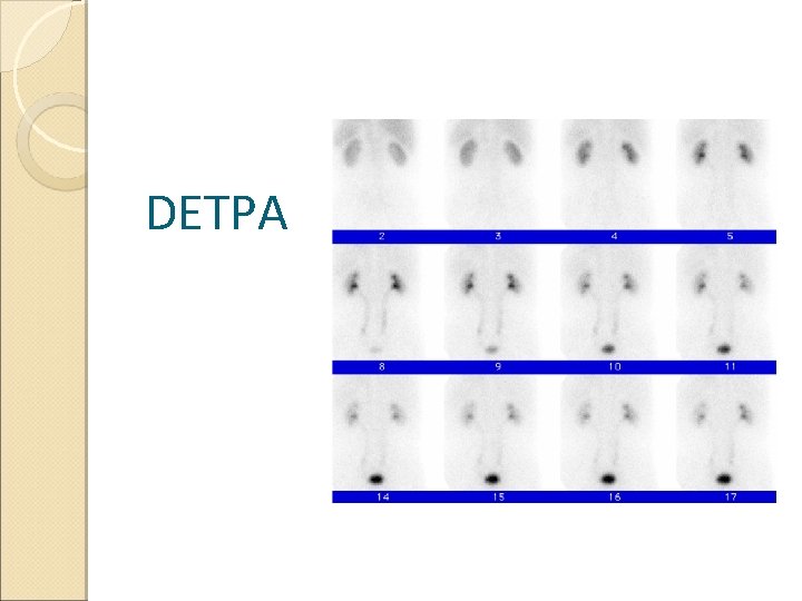 DETPA 