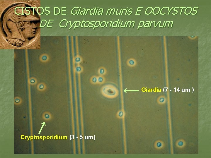 CISTOS DE Giardia muris E OOCYSTOS DE Cryptosporidium parvum Giardia (7 - 14 um