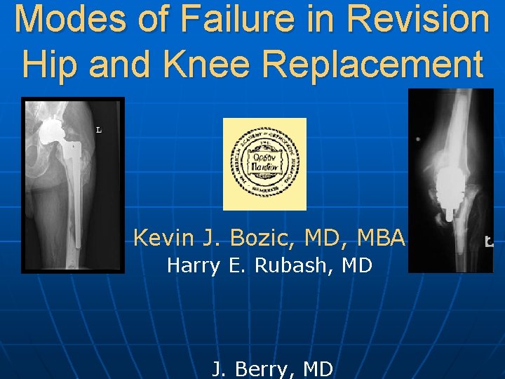 Modes of Failure in Revision Hip and Knee Replacement Kevin J. Bozic, MD, MBA