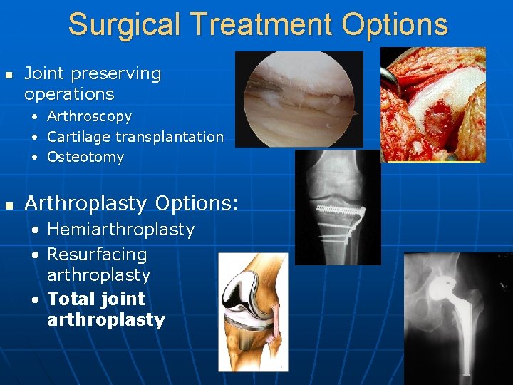 Surgical Treatment Options n Joint preserving operations • • • n Arthroscopy Cartilage transplantation