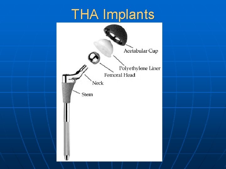 THA Implants 