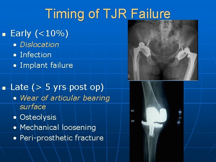 Timing of TJR Failure n Early (<10%) • • • n Dislocation Infection Implant