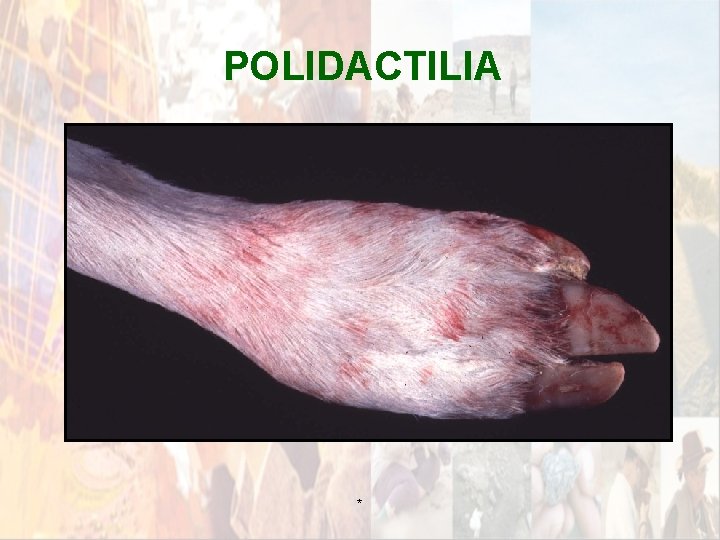 POLIDACTILIA * POLIDACTILIA *