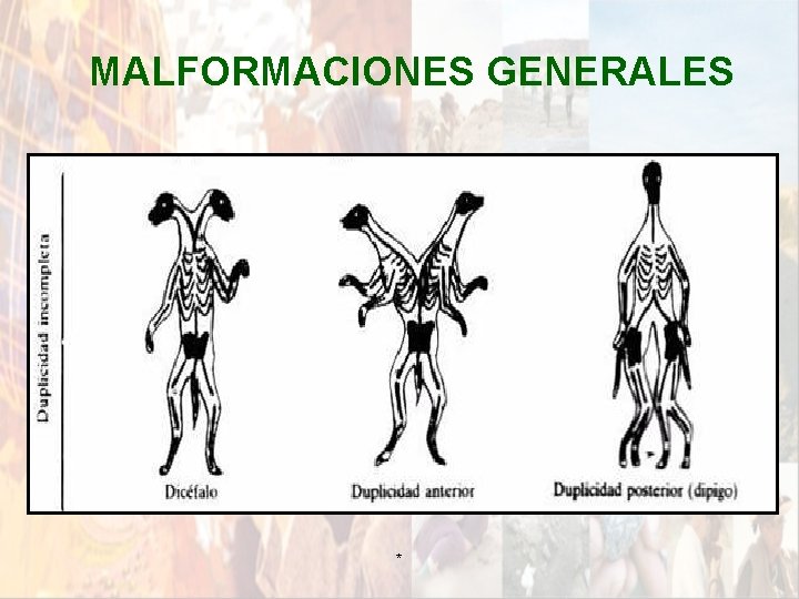 MALFORMACIONES GENERALES * MALFORMACIONES GENERALES *