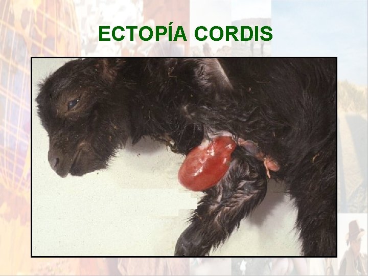 ECTOPÍA CORDIS * ECTOPÍA CORDIS *