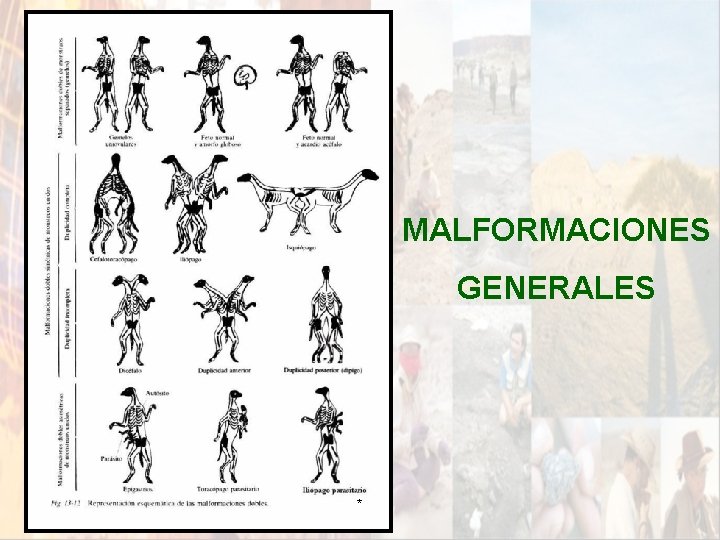 MALFORMACIONES GENERALES * MALFORMACIONES GENERALES *