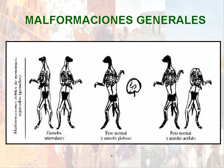 MALFORMACIONES GENERALES * MALFORMACIONES GENERALES *