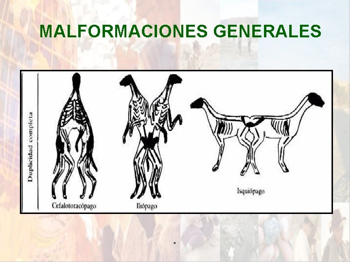 MALFORMACIONES GENERALES * MALFORMACIONES GENERALES *